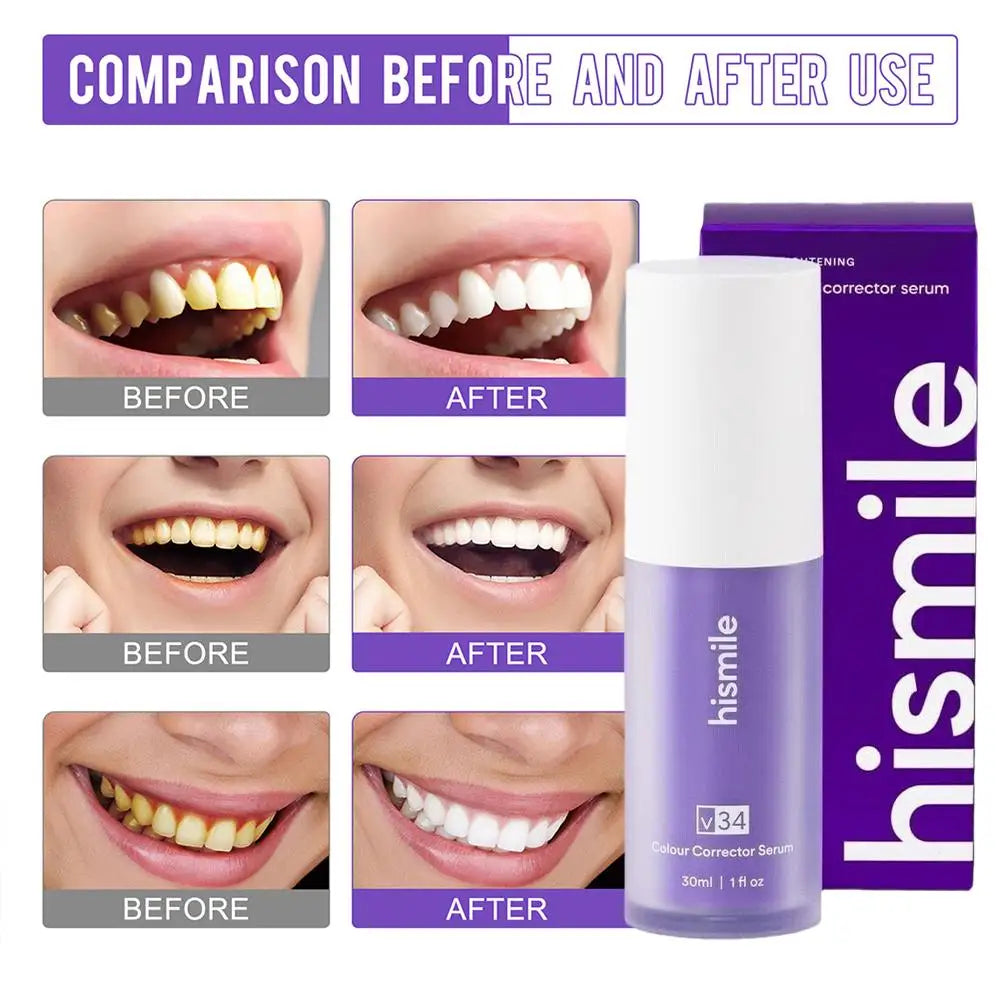V34 Purple Teeth Whitening Foam – 30ml