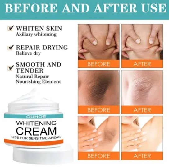 Sensitive Area Whitening Cream For Private Parts,